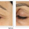 RoC  Retinol Correxion Line Smoothing Eye Cream  Visibly Reduces Puffiness  Dark Circles  AntiWrinkle and Ageing  15 ml