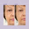 Beverly Hills Instant Facelift  Reduce Fine Lines and Remove Puffiness in 90 Seconds Rapid Reduction of Wrinkles Instant Lift Eye Serum 30ml  1oz