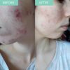 SKINICIAN Purifying Cleansing Gel  Gentle Face Wash with Witch Hazel  Green Tea  Rebalancing Facial Cleanser for Oily Combination Skin  Removes E