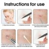 Blackhead Remover Tool Kit 10 Pieces Blackhead Remover Pimple Popping Tool Kit with Black Bag Comedone Extractor Tools for Acne Blackhead Whitehe
