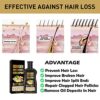 Ginger Shampoo Ginger Hair Growth Shampoo Anti Hair Loss Shampoo Natural Organic Ginger Shampoo Promotes Hair Growth Antidandruff  Antiitching Gi