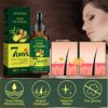 Ginger hair care essential oil can improve womens damaged hairs dryness breakage and bifurcation and the nutrient solution needs no washing 30ml.